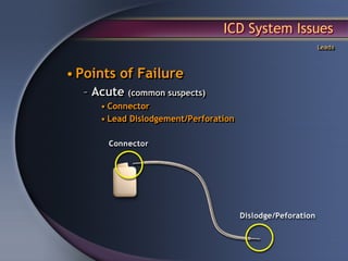 ICD System Issues
                                               Leads



• Points of Failure
  – Acute (common suspects)
     • Connector
     • Lead Dislodgement/Perforation
 