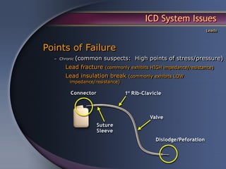 ICD System Issues
                                                                Leads



Points of Failure
  – Chronic   (common suspects: High points of stress/pressure)
       Lead fracture   (commonly exhibits HIGH impedance/resistance)

       Lead insulation break     (commonly exhibits LOW
         impedance/resistance)
 
