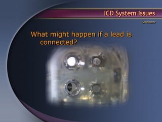 ICD System Issues
                                 Connector



What might happen if a lead is
  connected?
 