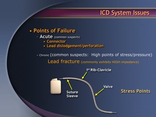 ICD System Issues

• Points of Failure
  – Acute (common suspects)
       • Connector
       • Lead dislodgement/perforation

   – Chronic   (common suspects: High points of stress/pressure)
           Lead fracture (commonly exhibits HIGH impedance)
 