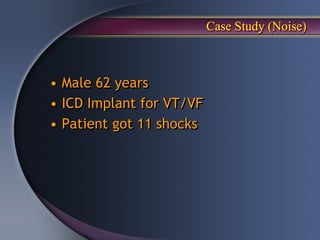 Case Study (Noise)



• Male 62 years
• ICD Implant for VT/VF
• Patient got 11 shocks
 