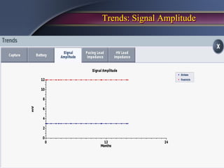 Trends: Signal Amplitude
 