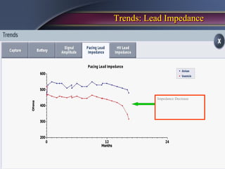 Trends: Lead Impedance




          Impedance Decrease
 