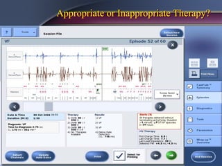 Appropriate or Inappropriate Therapy?
 