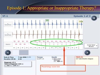 Episode 1: Appropriate or Inappropriate Therapy?




                  Morphology score low
 