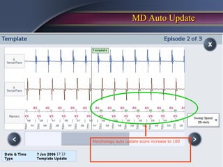 MD Auto Update




Morphology auto update score increase to 100
 