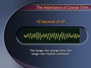 The Importance of Charge Time


    10 Seconds of VF




The longer the charge time, the
 longer this rhythm continues.
 