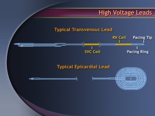 High Voltage Leads
 