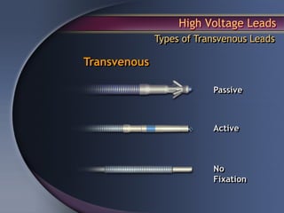 High Voltage Leads
              Types of Transvenous Leads

Transvenous

                          Passive



                          Active



                          No
                          Fixation
 