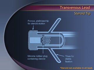 Transvenous Lead
               Steroid Tip




*Steroid not available in all leads
 
