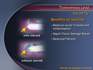 Transvenous Lead
                    Steroid Tip
Benefits of Steroid:
• Reduces acute Trauma and
  Inflammation
• Rapid Tissue Damage Repair
• Reduced Fibrosis




      *Steroid not available in all leads
 