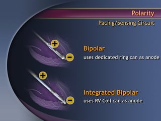 Polarity
      Pacing/Sensing Circuit



Bipolar
uses dedicated ring can as anode




Integrated Bipolar
uses RV Coil can as anode
 
