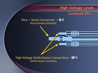 High Voltage Leads
                                          Connector Pins
    Pace / Sense Connection = IS-1
          (International Standard)




High Voltage Defibrillation Connections = DF-1
          (Defibrillation Standard)
 