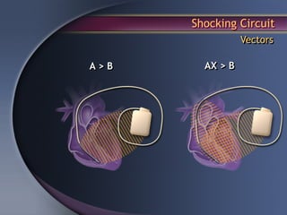 Shocking Circuit
                 Vectors

A>B     AX > B
 