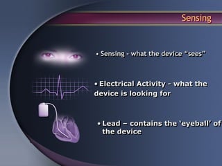 Sensing


• Sensing - what the device “sees”



• Electrical Activity - what the
device is looking for



• Lead – contains the ‘eyeball’ of
  the device
 