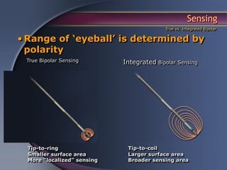 Sensing
                                           True vs. Integrated Bipolar


• Range of ‘eyeball’ is determined by
  polarity
 True Bipolar Sensing        Integrated Bipolar Sensing




  Tip-to-ring                 Tip-to-coil
  Smaller surface area        Larger surface area
  More “localized” sensing    Broader sensing area
 