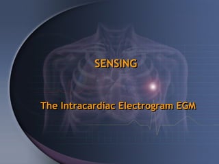 SENSING


The Intracardiac Electrogram EGM
 