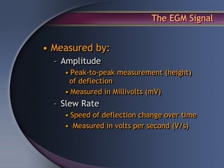 The EGM Signal


• Measured by:
  – Amplitude
    • Peak-to-peak measurement (height)
     of deflection
    • Measured in Millivolts (mV)
  – Slew Rate
    • Speed of deflection change over time
    • Measured in volts per second (V/s)
 