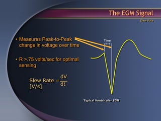 The EGM Signal
                                                           Slew Rate




• Measures Peak-to-Peak
  change in voltage over time

• R >.75 volts/sec for optimal
  sensing

                  dV
      Slew Rate =
      [V/s]       dt


                                 Typical Ventricular EGM
 