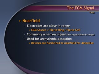 The EGM Signal
                                                   Fields




• Nearfield
  – Electrodes are close in range
     • EGM Source = Tip-to-Ring / Tip-to-Coil
  – Commonly a narrow signal (less myocardium in range)
  – Used for arrhythmia detection
     • Devices are hardwired to nearfield for detection
 