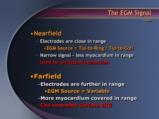 The EGM Signal
                                               Fields




•Nearfield
  – Electrodes are close in range
     •EGM Source = Tip-to-Ring / Tip-to-Coil
  – Narrow signal – less myocardium in range
  – Used for arrhythmia detection


•Farfield
  –Electrodes are further in range
    •EGM Source = Variable
  –More myocardium covered in range
  –Can resemble surface EKG
 