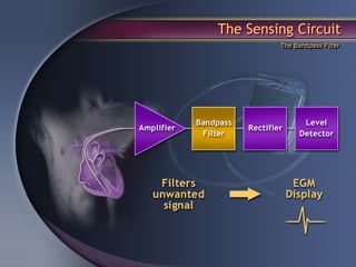 The Sensing Circuit
         The Bandpass Filter
 