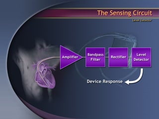 The Sensing Circuit
            Level Detector
 