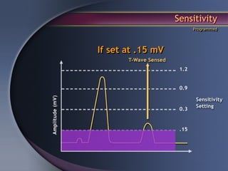 Sensitivity
                       Programmed




If set at .15 mV
 