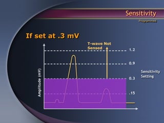 Sensitivity
                                   Programmed




If set at .3 mV
                  T-wave Not
                  Sensed
 