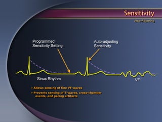 Sensitivity
                                                  Auto-Adjusting




• Allows sensing of fine VF waves
• Prevents sensing of T-waves, cross-chamber
   events, and pacing artifacts
 