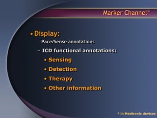 Marker Channel™


• Display:
  – Pace/Sense annotations
  – ICD functional annotations:
    • Sensing
    • Detection
    • Therapy
    • Other information



                                  * in Medtronic devices
 