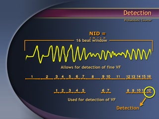 Detection
        Probabilistic Counter




NID =
12/16
 