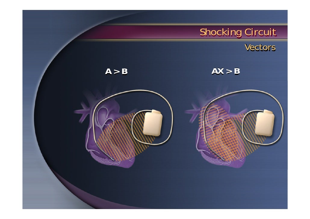 Basic ICD treatment_lecture