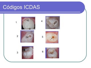 Icdas | PPT