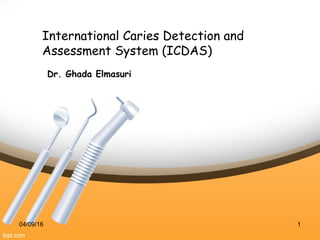 International Caries Detection and
Assessment System (ICDAS)
Dr. Ghada Elmasuri
04/09/16 1
 