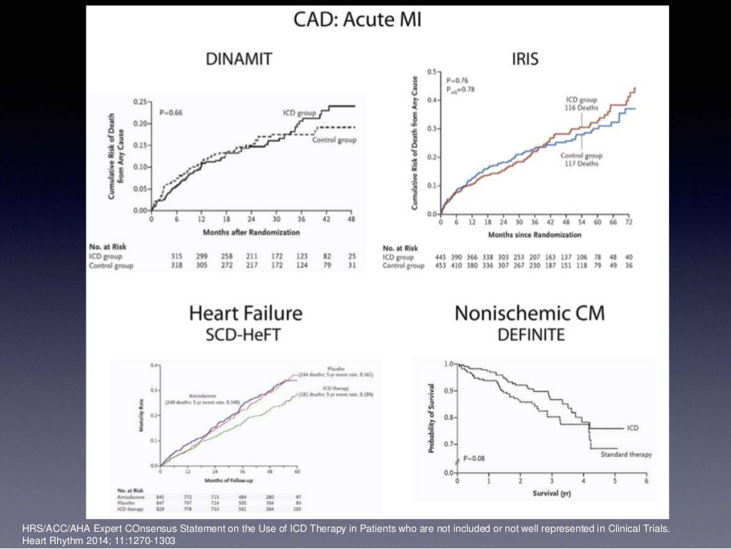 Implantable Cardioverter Defibrillator the evidence behind the guid…