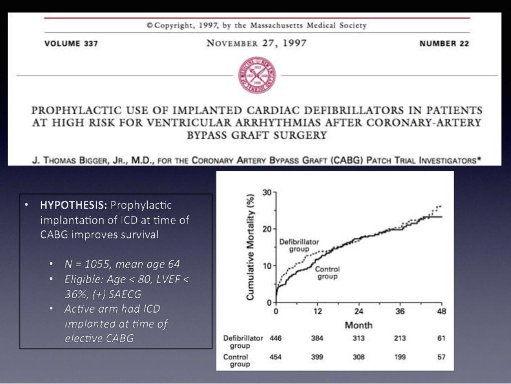 Implantable Cardioverter Defibrillator the evidence behind the guid…