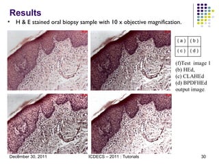 Results H & E stained oral biopsy sample with 10 x objective magnification. Test  image 1 (b) HEd,  (c) CLAHEd  (d) BPDFHEd output image .  ( a ) ( b ) ( c ) ( d ) 