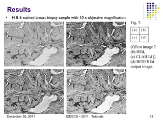 Results H & E stained breast biopsy sample with 10 x objective magnification. Fig. 7.  Test image 2 (b) HEd,  (c) CLAHEd []  (d) BPDFHEd output image .  ( a ) ( b ) ( c ) ( d ) 