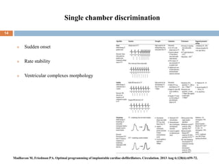 Single chamber discrimination
 Sudden onset
 Rate stability
 Ventricular complexes morphology
14
Madhavan M, Friedman PA. Optimal programming of implantable cardiac-defibrillators. Circulation. 2013 Aug 6;128(6):659-72.
 