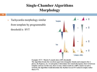 Single-Chamber Algorithms
Morphology
 Tachycardia morphology similar
from template by programmable
threshold is SVT
Example: SVT = Match (% match above 60% threshold)
The algorithm breaks the waveform apart into triangular chunks and compares the A
pieces, the B pieces, etc. At each point, it determines how much discrepancy there is between
template and test. In this case, there is none, which results in a 100% match. In such a
scenario, the algorithm would determine the rhythm was an SVT (sinus in origin) rather
than a VT.
18
 
