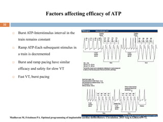 Factors affecting efficacy of ATP
 Burst ATP-Interstimulus interval in the
train remains constant
 Ramp ATP-Each subsequent stimulus in
a train is decremented
 Burst and ramp pacing have similar
efficacy and safety for slow VT
 Fast VT, burst pacing
32
Madhavan M, Friedman PA. Optimal programming of implantable cardiac-defibrillators. Circulation. 2013 Aug 6;128(6):659-72.
 
