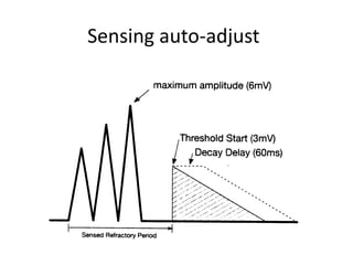 Sensing auto-adjust
 