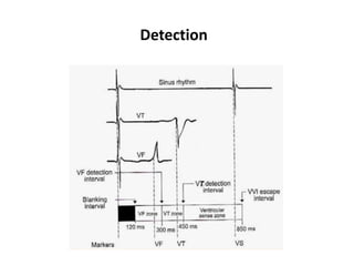 Detection
 