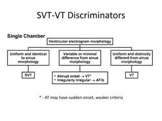 SVT-VT Discriminators
* - AT may have sudden onset, weaker criteria
 