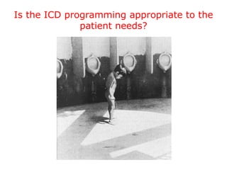 Is the ICD programming appropriate to the
patient needs?
 