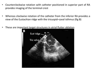 INTRACARDIAC ECHOCARDIOGRAPH (ICE) | PPTX