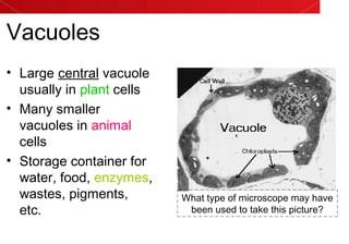 Vacuoles
• Large central vacuole
usually in plant cells
• Many smaller
vacuoles in animal
cells
• Storage container for
water, food, enzymes,
wastes, pigments,
etc.
What type of microscope may have
been used to take this picture?
 