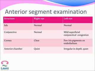 Structure Right eye Left eye
lids Normal Normal
Conjunctiva Normal Mild superficial
conjunctival congestion
Cornea Clear Few iris pigments on
endothelium
Anterior chamber Quiet Irregular in depth, quiet
Anterior segment examination
 