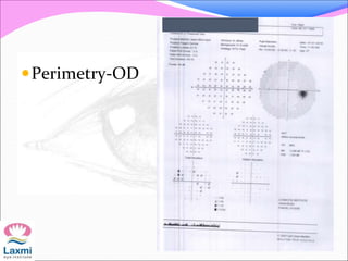 Perimetry-OD
 